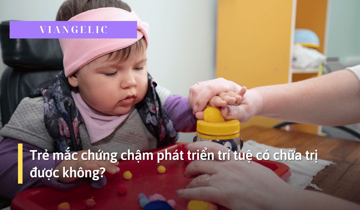 Trẻ mắc chứng chậm phát triển trí tuệ có chữa trị được không?